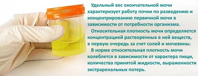 Удельный вес мочи это. Удельный вес мочи. удельная плотность мочи. удельный вес мочи выше нормы. удельный вес плотность мочи.