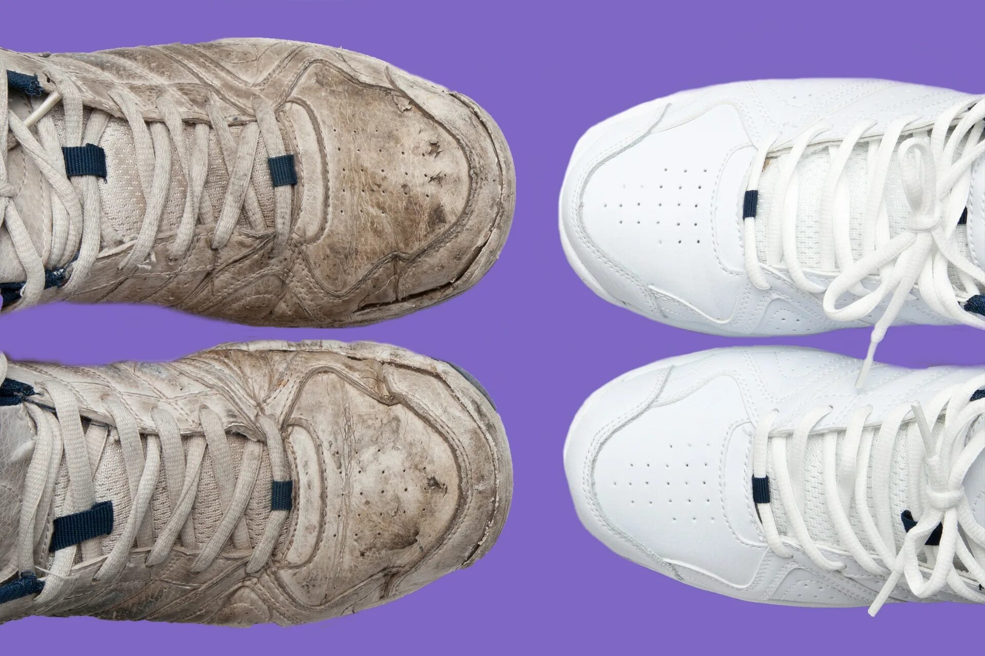 Грязные белые кроссовки. Грязная обувь. Кроссовки до и после. Кроссовки до и после чистки.