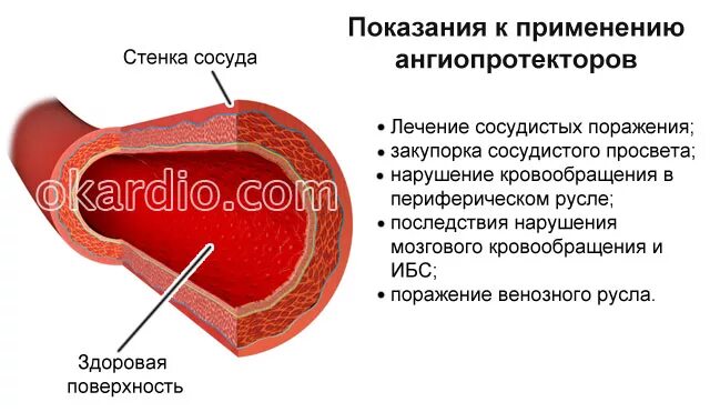 Толстая стенка сосуда. Лекарство для хрупких сосудов. Укрепление кровеносных сосудов.