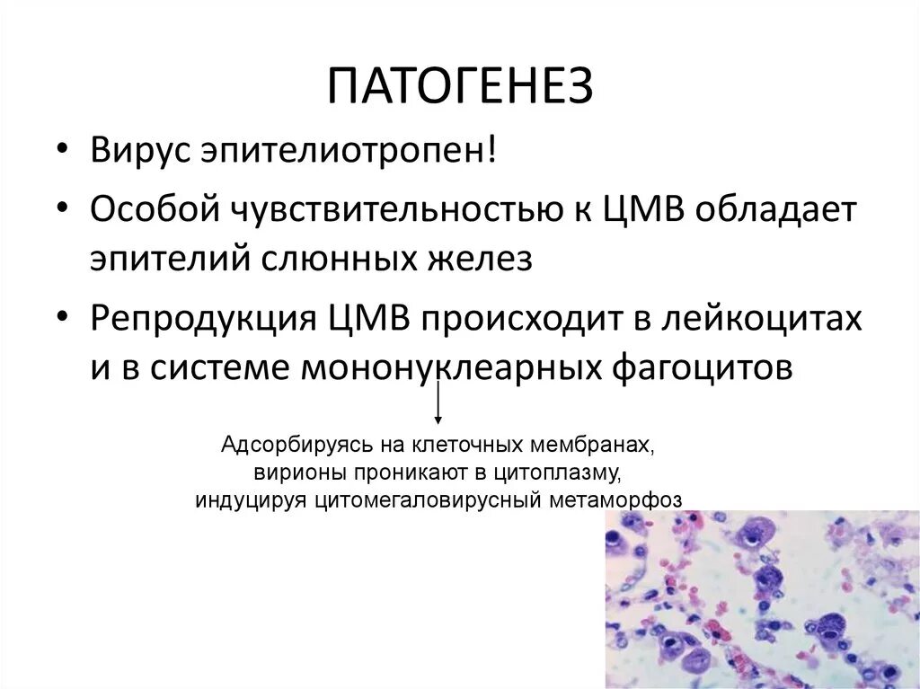 Вирусы патогенез. Цитомегаловирус патогенез схема. Патогенез ЦМВ инфекции. Цитомегаловирусный сиалоаденит патогенез.