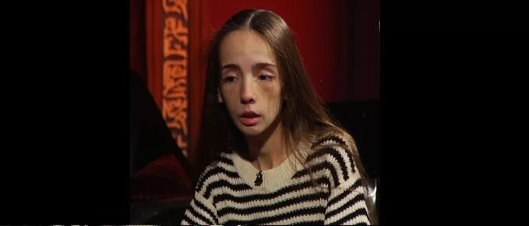 Катя девушка с анорексией из битвы экстрасенсов. Катя с анорексией из битвы экстрасенсов.