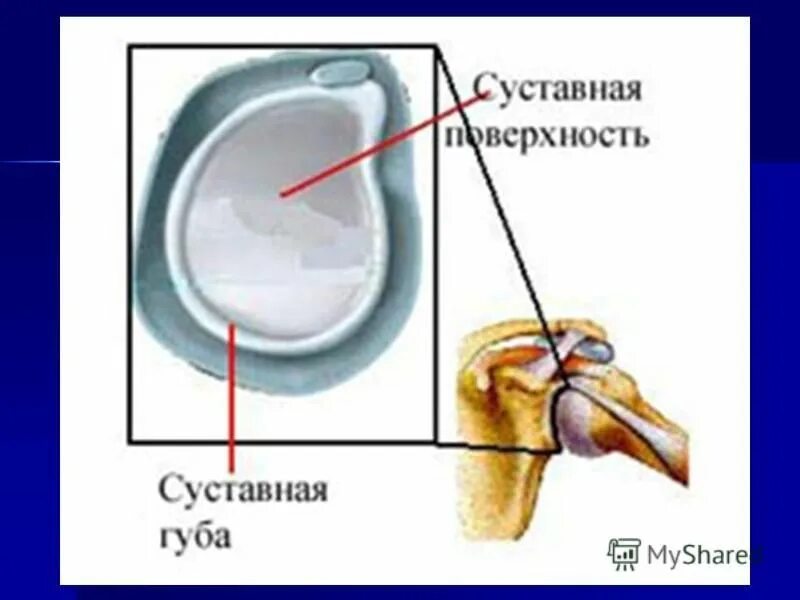 Хрящевая суставная губа плечевого сустава. Отрыв хрящевой губы плечевого сустава. Хрящевая суставная губа плечевого сустава. Сегмента суставной губы. Суставная губа плечевого сустава анатомия.