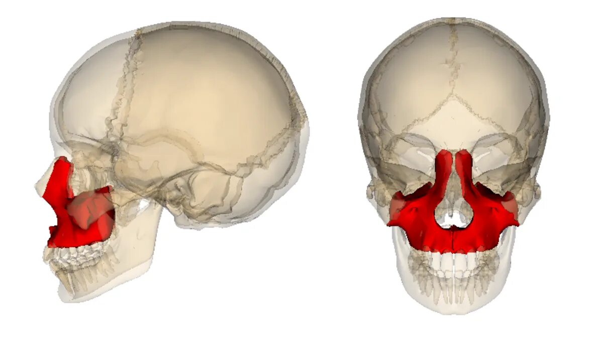 Большие лобные кости. Vomer Bone. Перелом верхней скуловой кости. Верхняя челюсть и клиновидная кость. Небная кость анатомия в черепе.