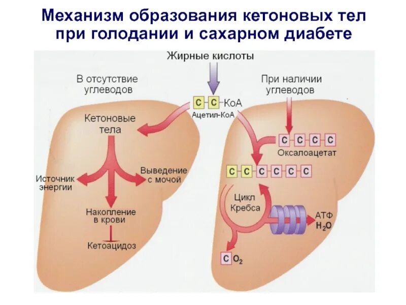 Механизм образования кетоновых тел. Механизм образования кетоновых тел при диабете. Синтез кетоновых тел при сахарном диабете. Сахарный диабет и кетоновые тела
