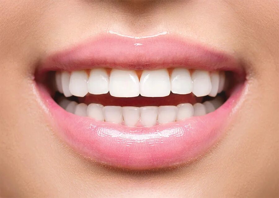 Аккуратнее зубы. Красивые зубы. Красивые ровные зубы. Красивая форма зубов. Красивая улыбка.