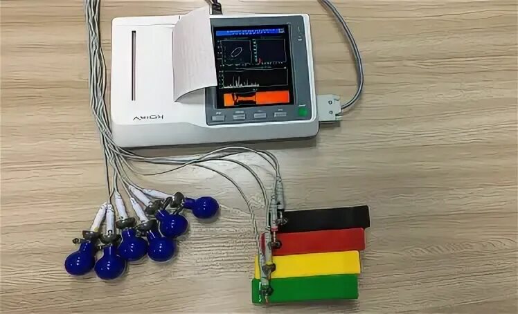 электрокардиограф эк3тц-3/6-04— 12 канальный. электрокардиограф эк3тц-3/6-04— 12 канальный. электрокардиограф трех/шестиканальный эк3тц-3/6-04 «аксион». эк3тц-3/6-04 аксион. электрокардиограф эк3тц-3/6-04— 12 канальный.