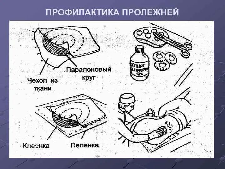 Профилактика пролежней. Обработка пролежней алгоритм Сестринское дело. Профилактика пролежней алгоритм Сестринское дело. Профилактика возникновения пролежней схема. Профилактика пролежней алгоритм Сестринское.