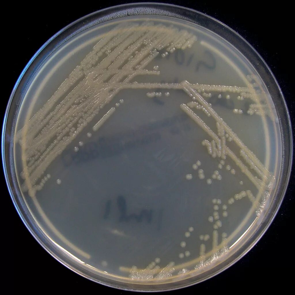 Синегнойная палочка псевдомоноз. Синегнойная палочка под микроскопом. Pseudomonas aeruginosa микробиология. Pseudomonas aeruginosa колонии. Бактерия синегнойная палочка