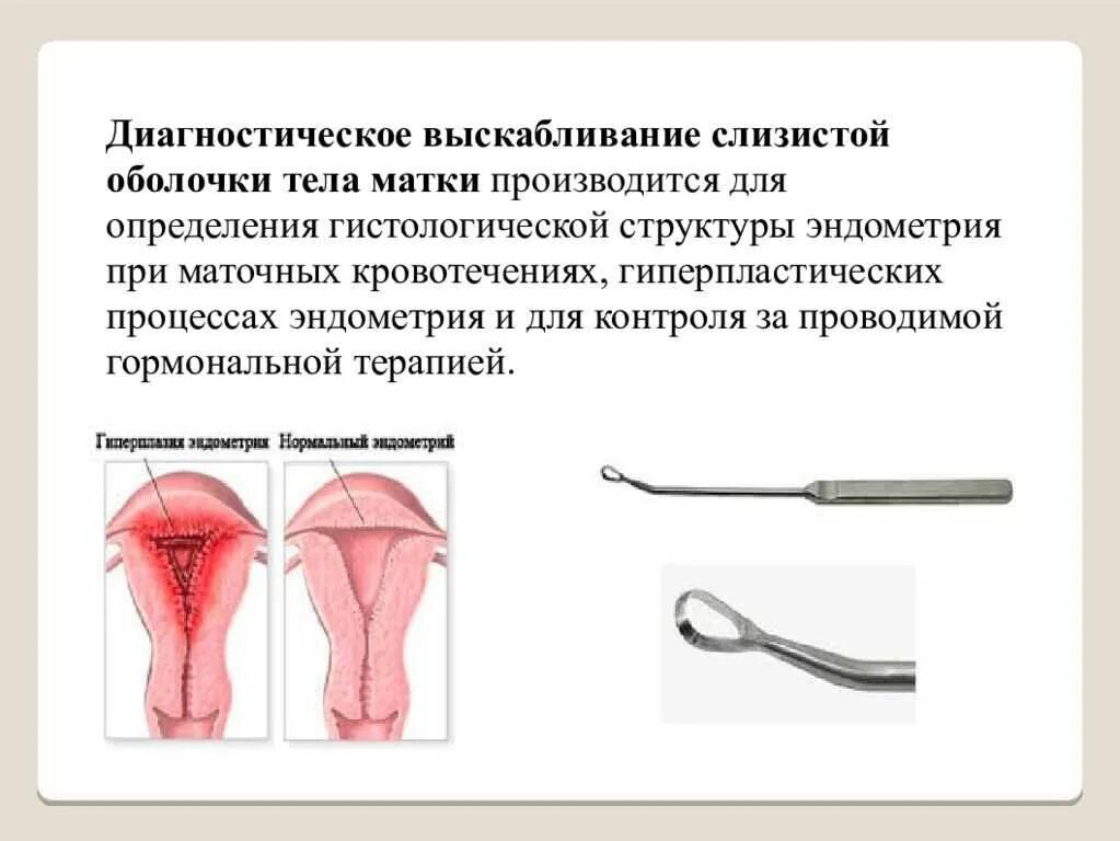 Как называется выскабливание. Раздельное (фракционное) диагностическое выскабливание. Инструментальная ревизия полости матки. Выскабливание слизистой оболочки. Выскабливание полости матки инструментарий.