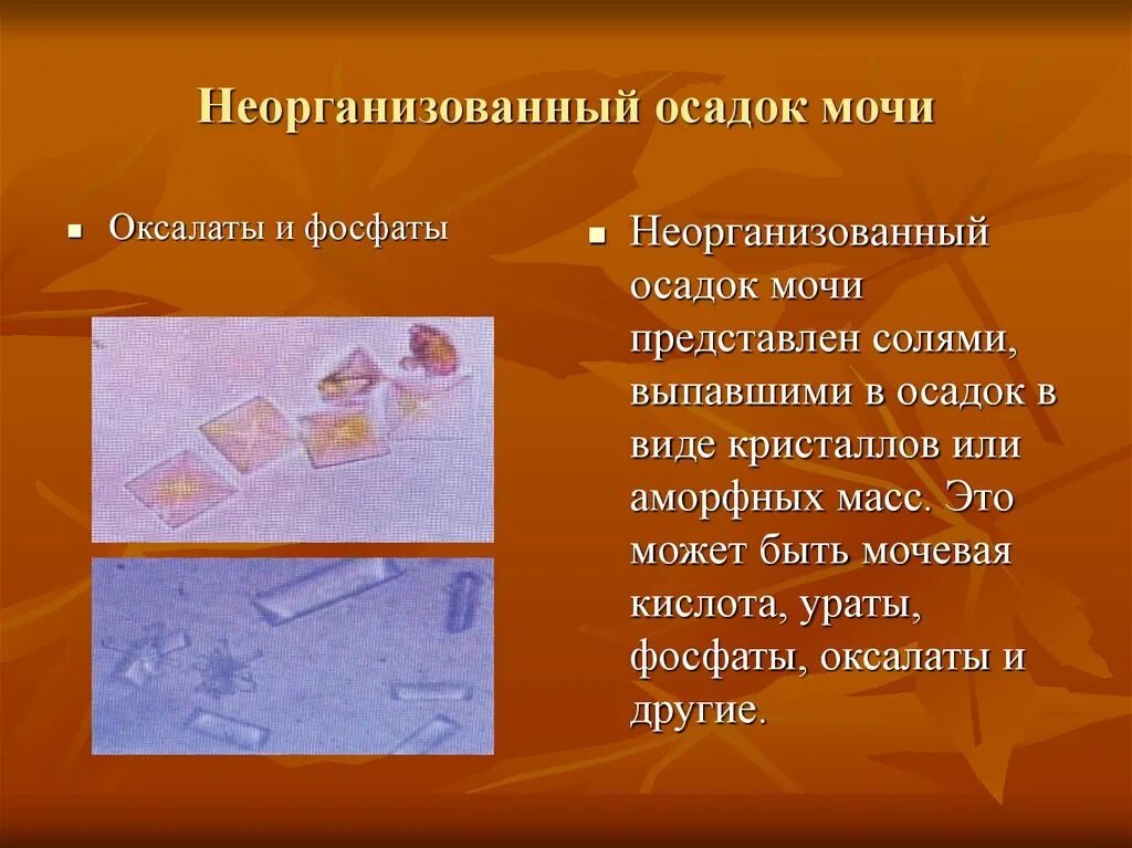 Виды осадков в моче. Неорганический осадок мочи. организованный и неорганизованный осадок мочи. организованный осадок в моче. организованные осадки мочи таблица.