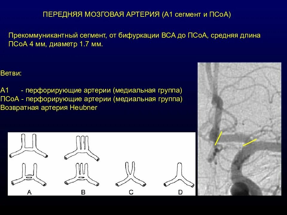 Сегменты головного мозга