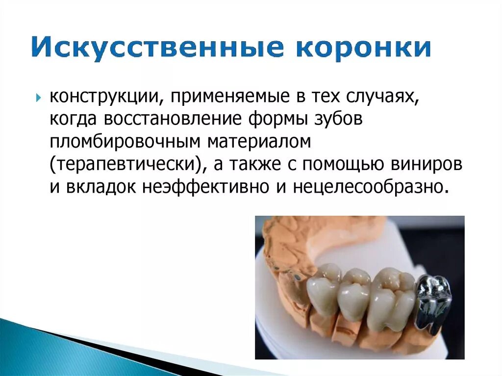 Классификация коронки зуба. Искусственные коронки. классификация искусственных коронок. материалы для искусственных коронок.