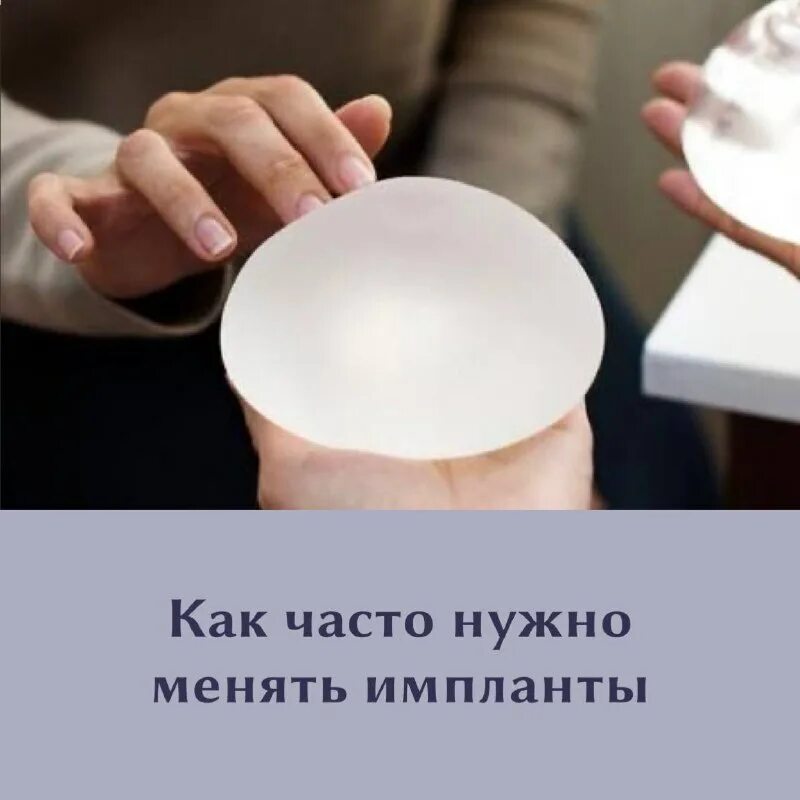 как часто меняют импланты. зубные импланты срок службы. пластика груди до и после. как часто меняют импланты. имплант системы xive.