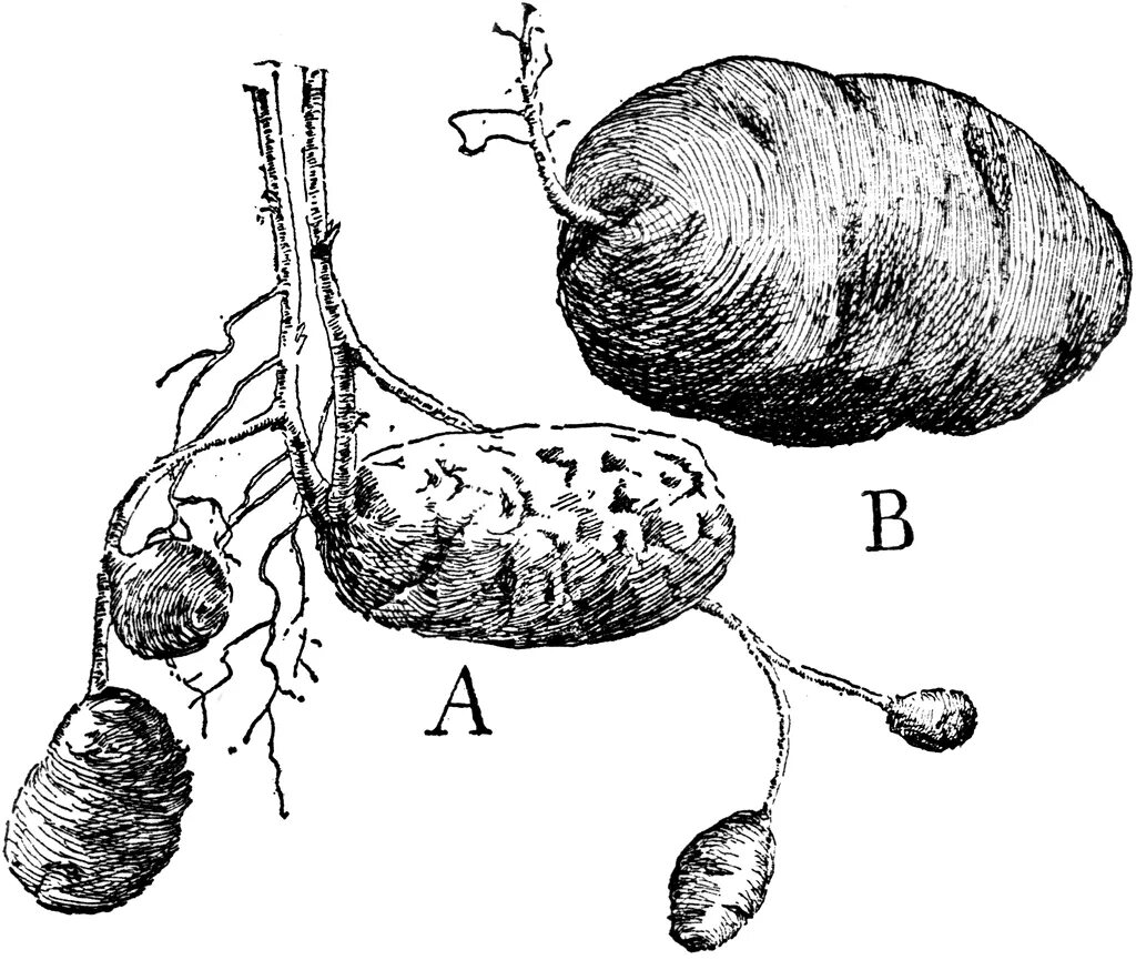 Клубень картофеля. Строение картошки. Клубень картошки рисунок. Клубень картофеля рисунок. Клубень картофеля и ус садовой земляники