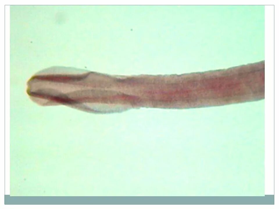 Сколекс дифиллоботриоза. Ленточные черви широкий лентец. Широкий лентец дифиллоботриоз. Широкий лентец плероцеркоид.