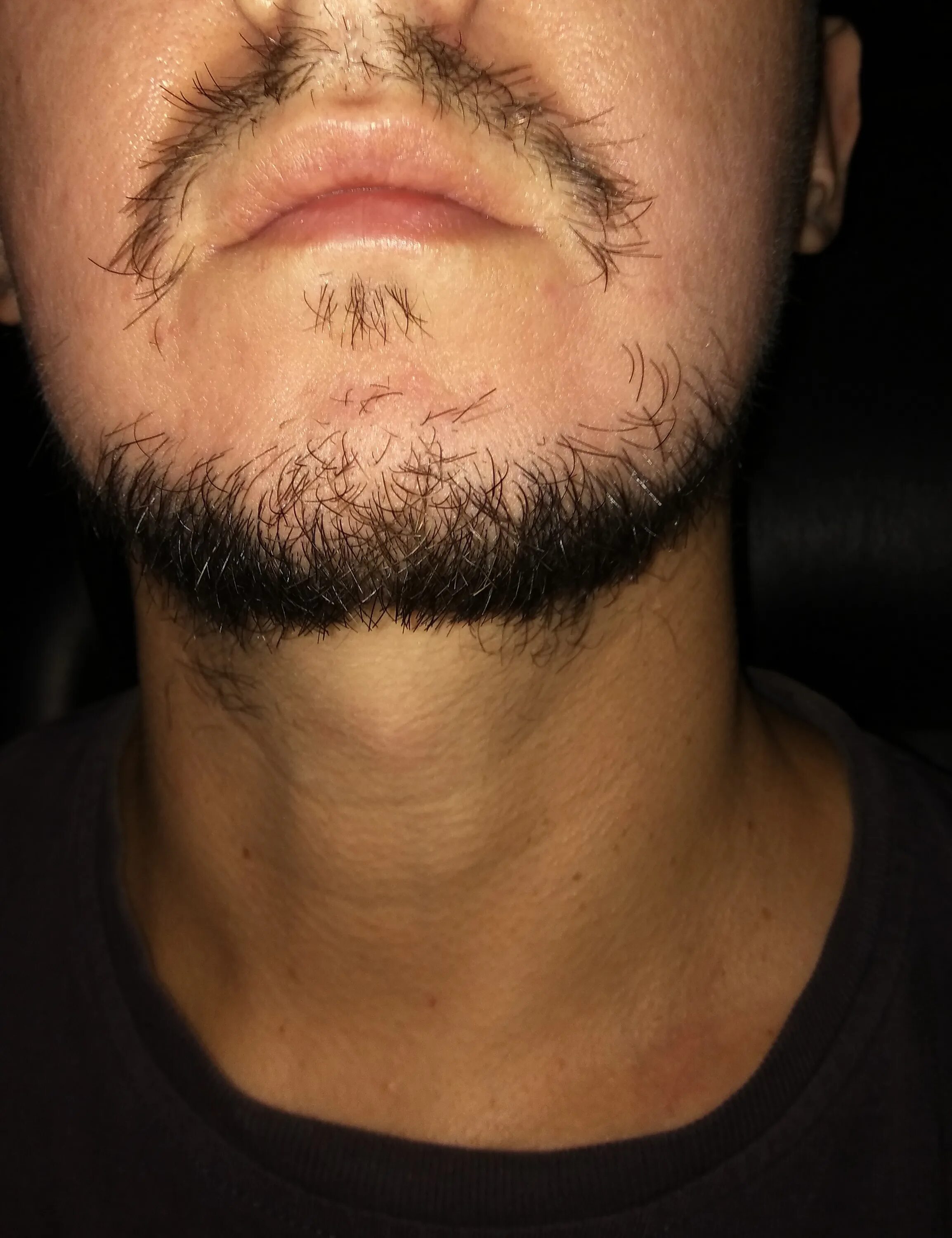 Растительность на лице у мужчин. Борода на подбородке. Бородка на подбородке. Редкая бородка на подбородке.