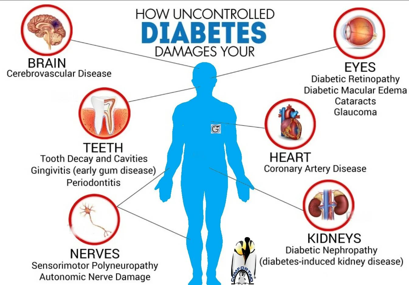 Diabetes Types.