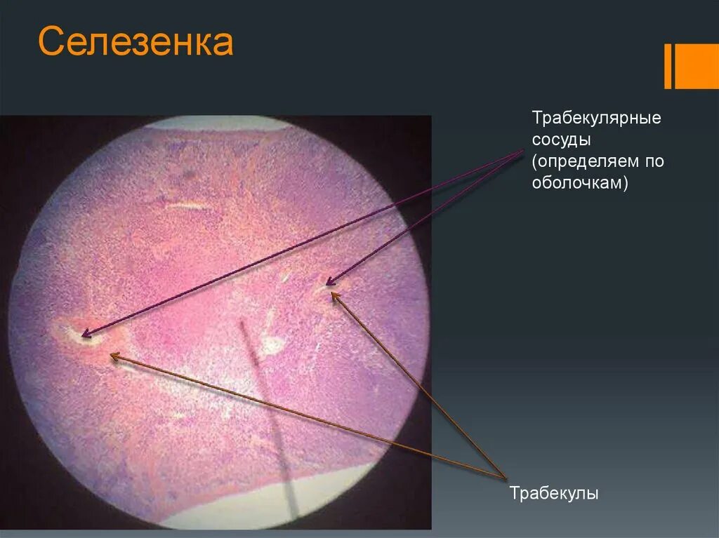 Селезенка препарат гистология. Трабекулы селезенки гистология. трабекулярная артерия гистология. трабекулярные сосуды селезенки. селезенка гистология.