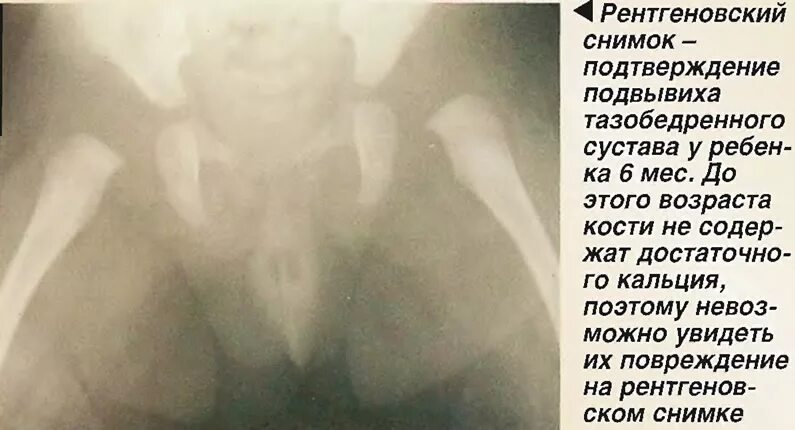 Вопросы рентгенологу: чем занимается врач, что лучше КТ или МРТ, вызывает ли рен
