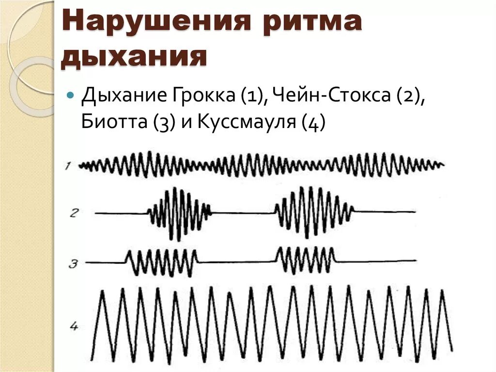 Нарушение частоты глубины и ритма дыхания. Патологические типы дыхания — Чейна-Стокса, Куссмауля. Нарушения ритма и глубины дыхания. Патологические типы дыхания (чейн-Стокса, Биота, Грокко, Куссмауля). Типы дыхания Куссмауля Чейна Стокса Биота.