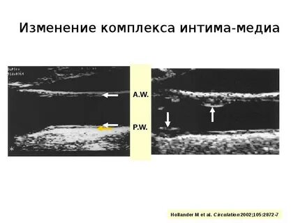 Комплекс меняться