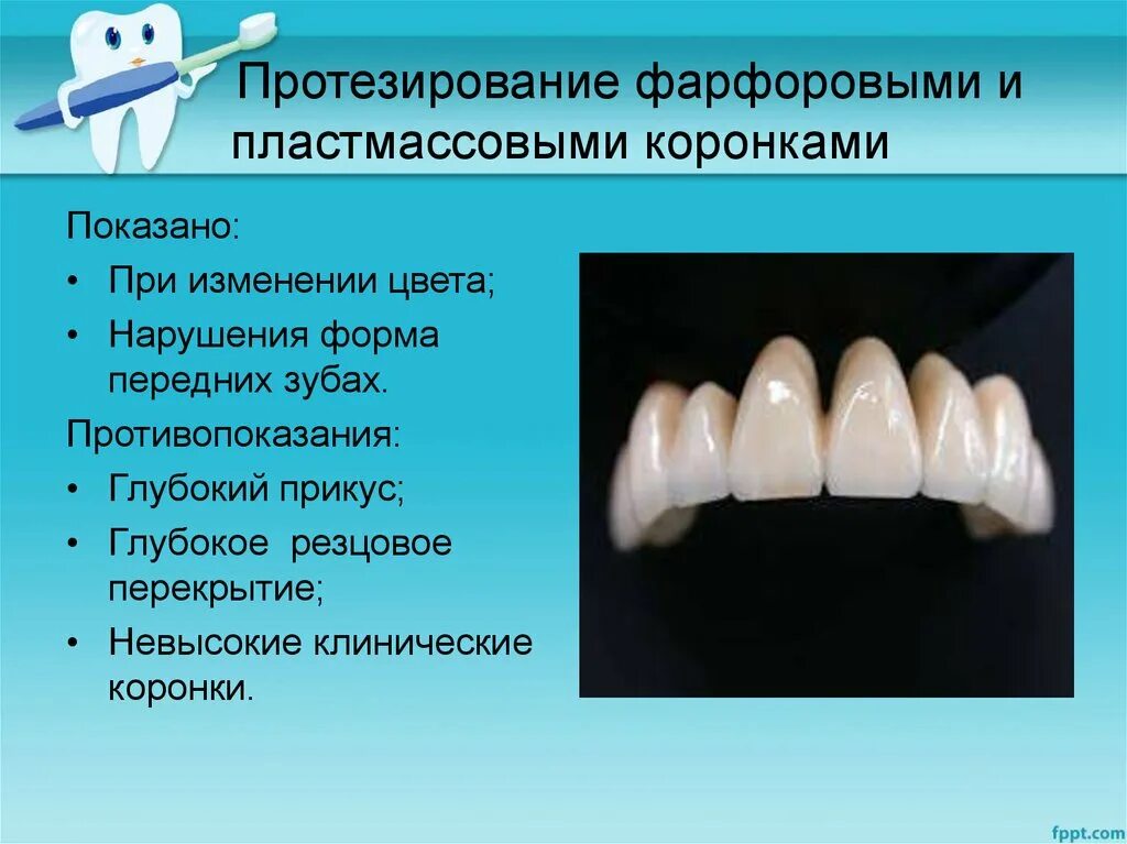 Пластмассовые и фарфоровые коронки. Пластмассовые коронки показания. Пластмассовые и фарфоровые зубы. Пластмассовые коронки показания и противопоказания. Какую функцию выполняет коронка зуба