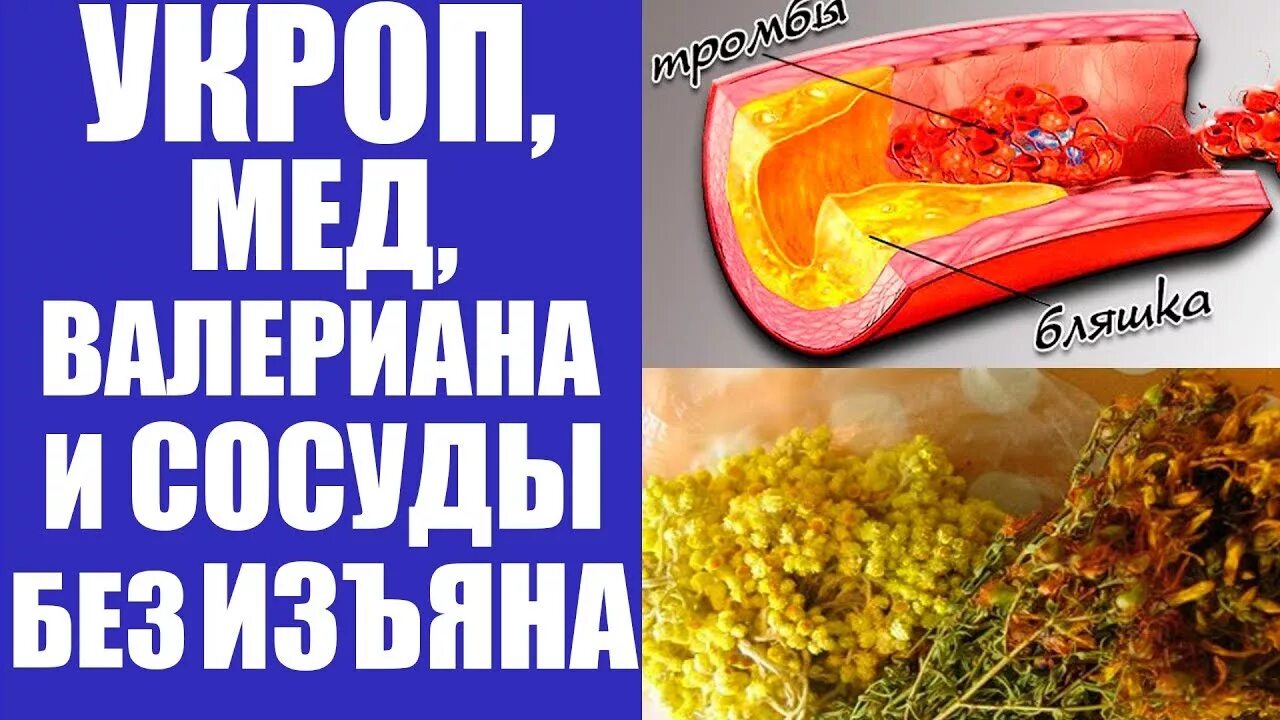 Чистка сосудов укропом. Мастер трав. Укроп мед валериана для сосудов. Укроп мед и валериана сотворят. Укроп мед валериана для сосудов.