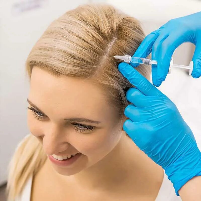 Bio cascad hair мезотерапия. Плазмотерапия (prp-терапия) для волос. Плазма для волос. Мезотерапия для волос. Prp плазмолифтинг для волос.