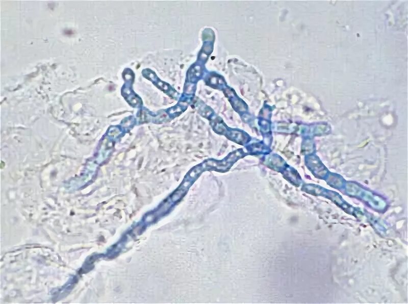 Trichophyton mentagrophytes. Trichophyton tonsurans. Трихофитон грибок ногтя. Мицелий грибов на коже