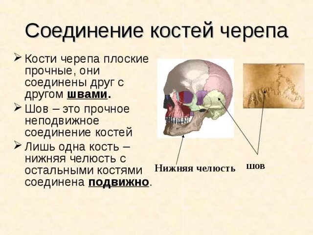 Шов теменных костей. Соединение костей мозгового отдела. Соединение костей мозгового отдела черепа. Тип соединения костей головного мозга. Характеристика соединения костей лицевого отдела черепа.