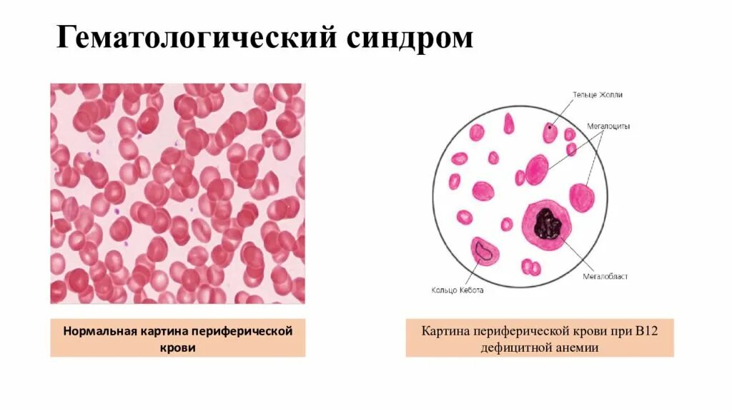 Фолиевая в эритроцитах