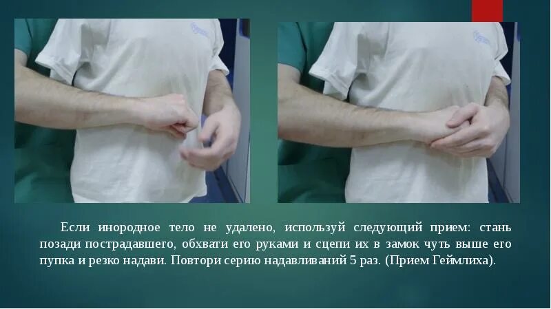 Что необходимо сделать для извлечения инородного