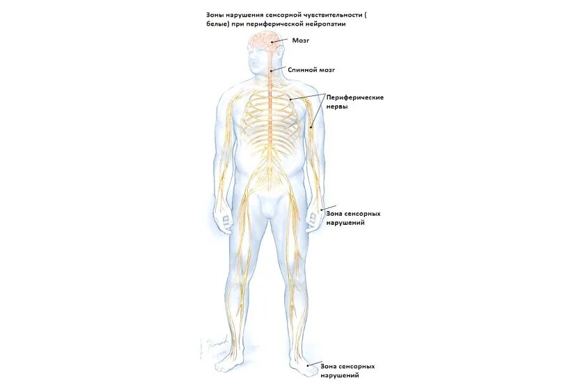 Повреждение периферических нервов. Травмы периферической нервной системы. В периферическом нерве после повреждения:. Периферический нерв.