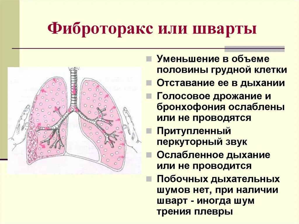 Легочный тип дыхания характерен. Фиброторакс шварты. Плевро-плевральные спайки. Синдром уплотнения плевры шварты.