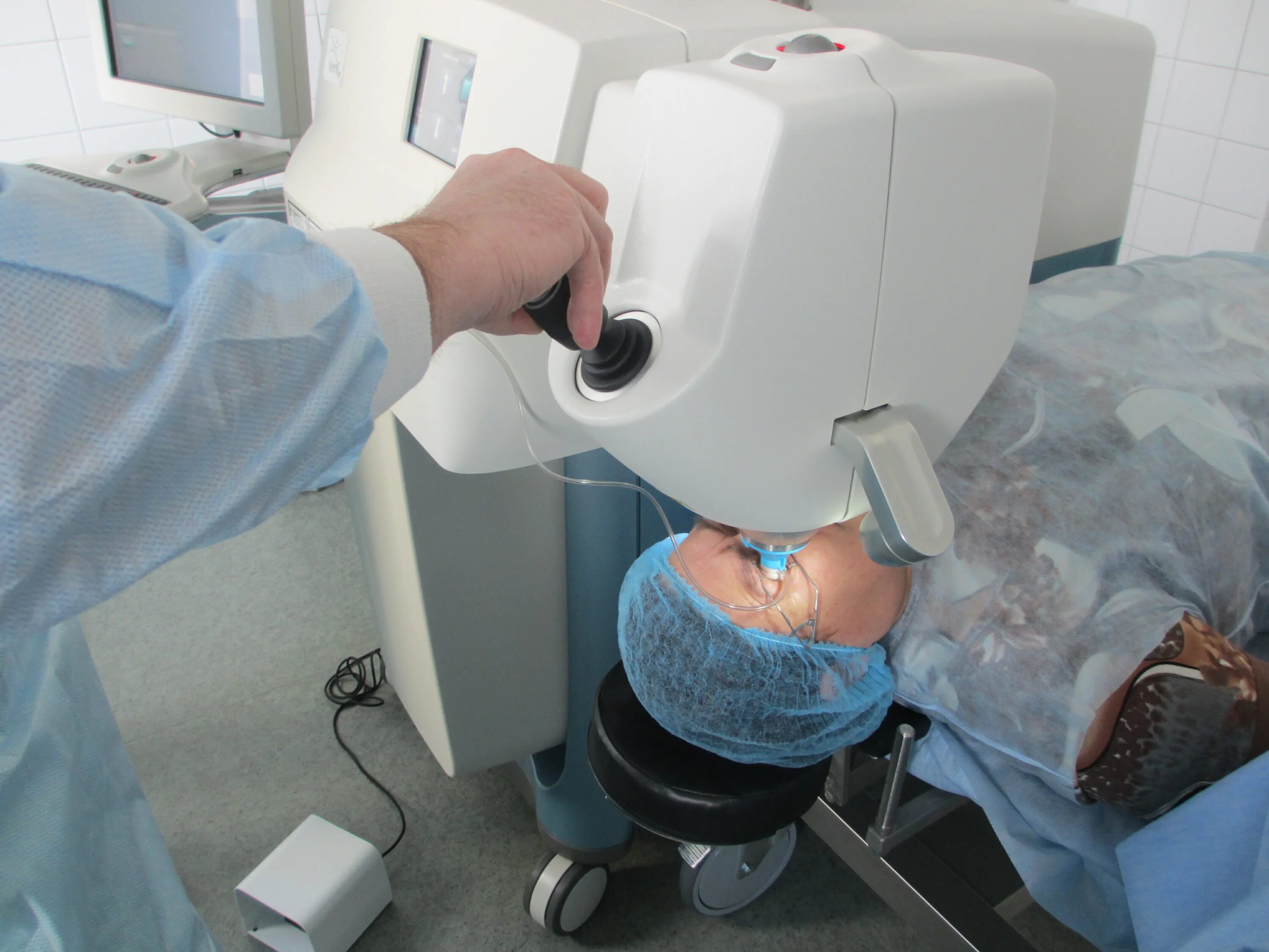 фемтосекундная коррекция зрения