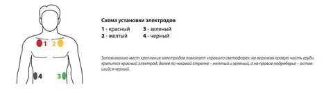 Экг красный желтый зеленый