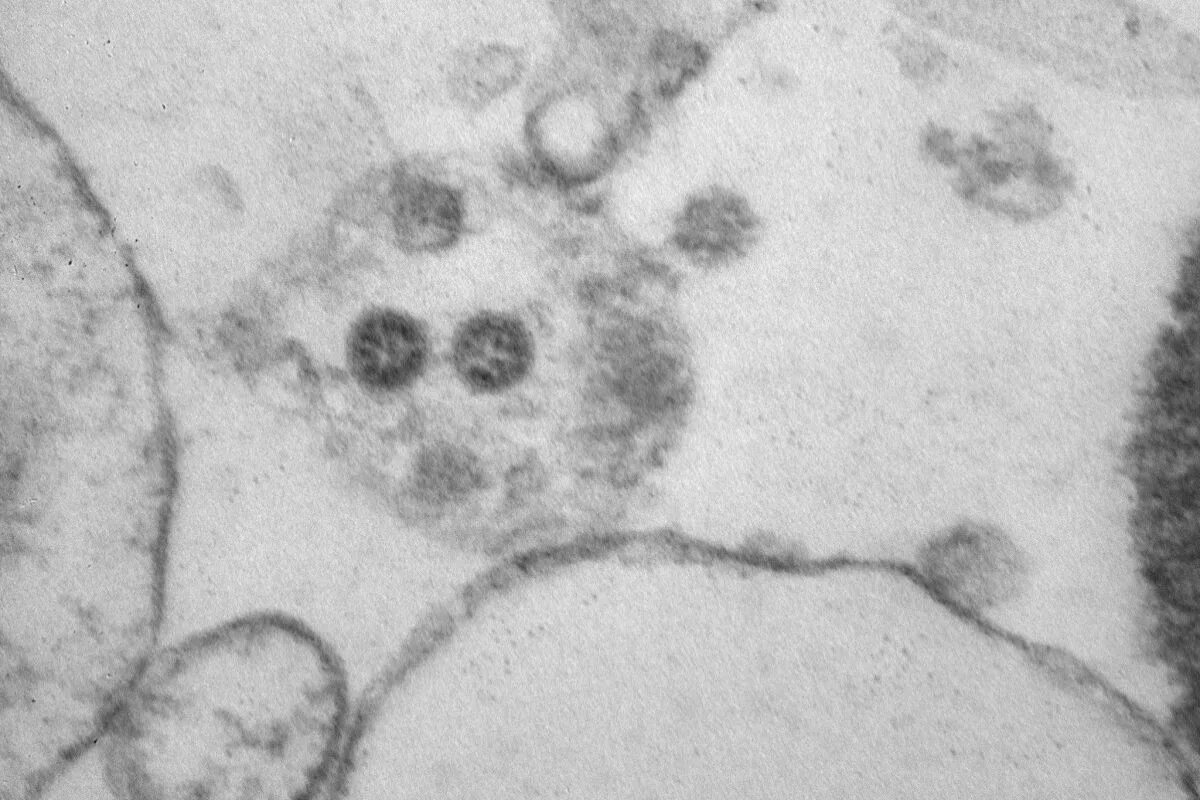 Ковид коронавирус Омикрон. Штамм вируса Омикрон под микроскопом. Вирус ковид Омикрон под микроскопом. Дельта штамм коронавируса под микроскопом. Штамм ковида 2024