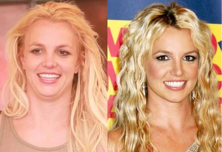 Памела андерсон до и после. Как выглядят звезды без. Звёзды без макияжа и фотошопа. Шакира без грима и макияжа. Звёзды без грима и макияжа и фотошопа.