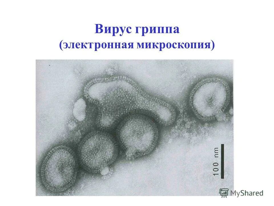 гриппа вирус три четыре. вирус гриппа род. вакцинация вирус. очень вырос в целом мире. гриппа вирус три четыре.