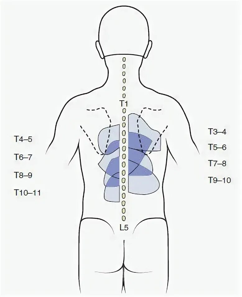 Схема боли в спине. Локализация боли в спине на картинках. Справа снизу спины. Спина схематически. Схема человек в низ спину.