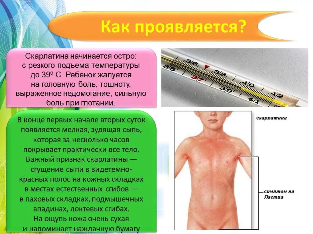 Стрептококковая скарлатина. Скарлатина у детей симптомы. Скарлатина характерные клинические проявления. Холодная кожа при температуре