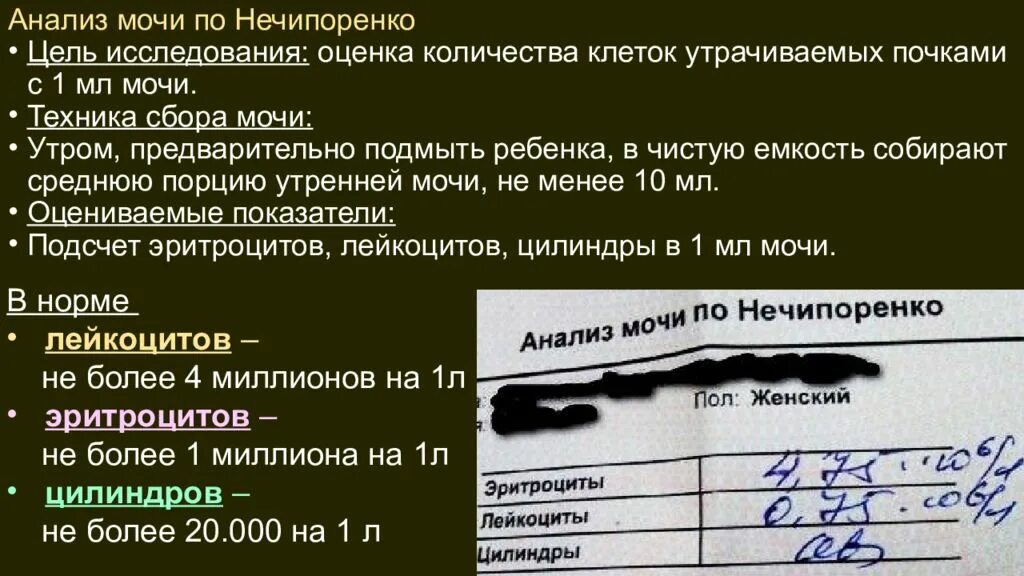 Оам по нечипоренко. Анализ мочи по Нечипоренко цель исследования. Нормативы анализов по Нечипоренко. Анализ мочи по Нечипоренко заключение норма. Норма эритроцитов в моче по Нечипоренко.