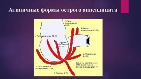 Острый аппендицит клинические рекомендации 2023 ответы