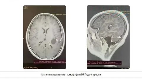 Алмазов мрт