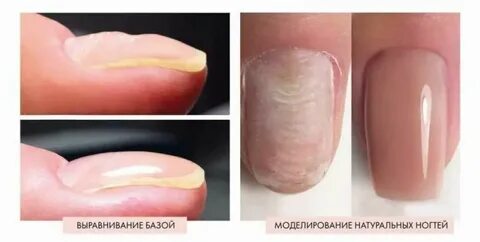 Можно ли укрепить ногти базой