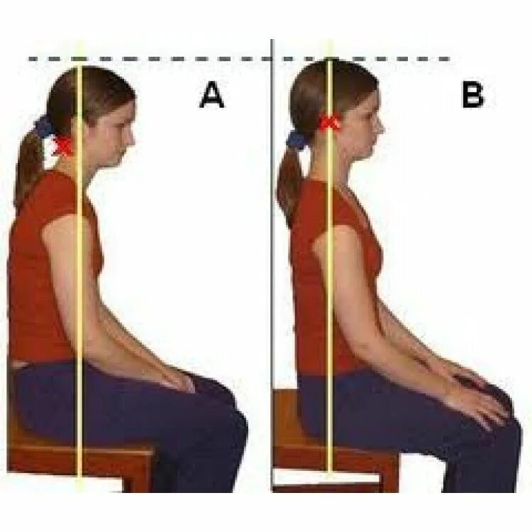 Как правильно держать спину. Осанка. Занятия для ровной спины. Выправление осанки. Приспособа для исправления осанки.