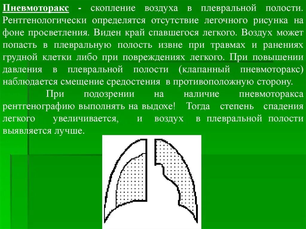 Признаки воздуха в легких. Скопление воздуха в плевральной полости. Открытый пневмоторакс скопление воздуха. Воздух в плевральной полости.