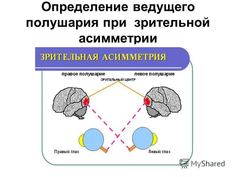 Ведомое полушарие