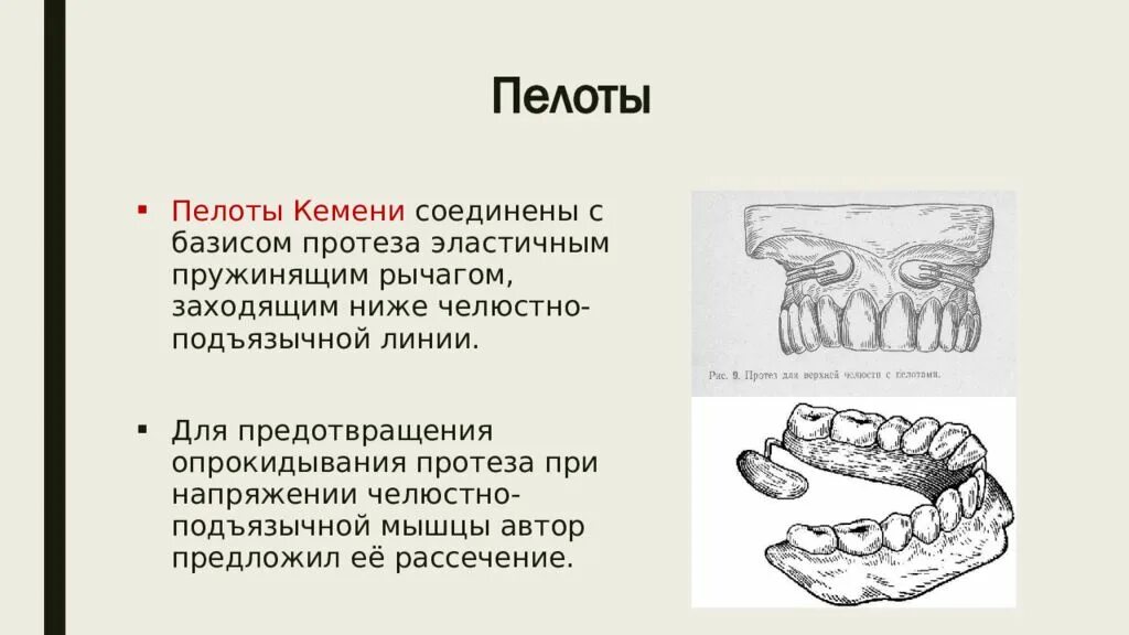 Линия базиса. Фиксация протезов пелоты. Кламмер Кемени. Методы фиксации съемных протезов кламмеры. Методы фиксации и стабилизации протезов.