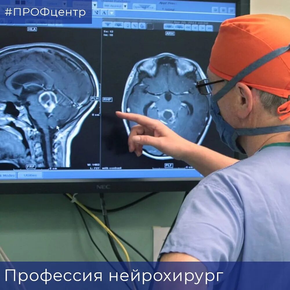 Мозг терапия япония. Современные технологии в нейрохирургии. Нейрохирургическая операция. Нейрохирургия головного мозга операция. Оперативные вмешательства на головном мозге.